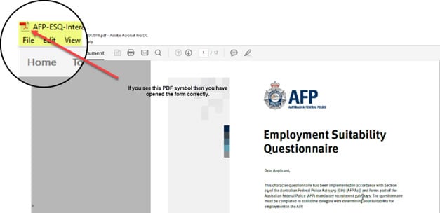 Employment Suitability Questionnaire Download Procedure Step